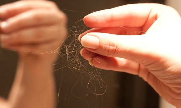 chute des cheveux