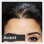 Andrea Avant Toppik