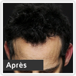 Jonathan Après Toppik