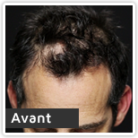 Jonathan Avant Toppik