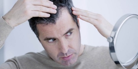  Die Ursachen von Haarausfall